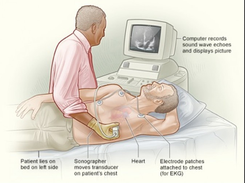 Heart Pacemaker Surgery 